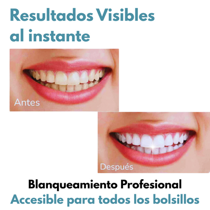 Blanqueador Dental V34: ¡Dientes blancos al instante!